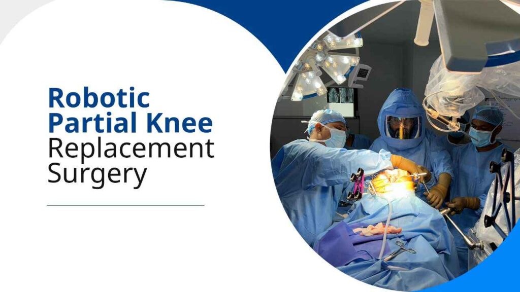 Robotic Partial Knee Replacement Surgery Dr Bakul Arora