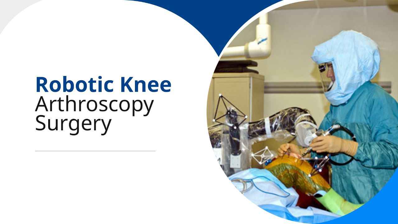 Robotic knee arthroscopy surgeries