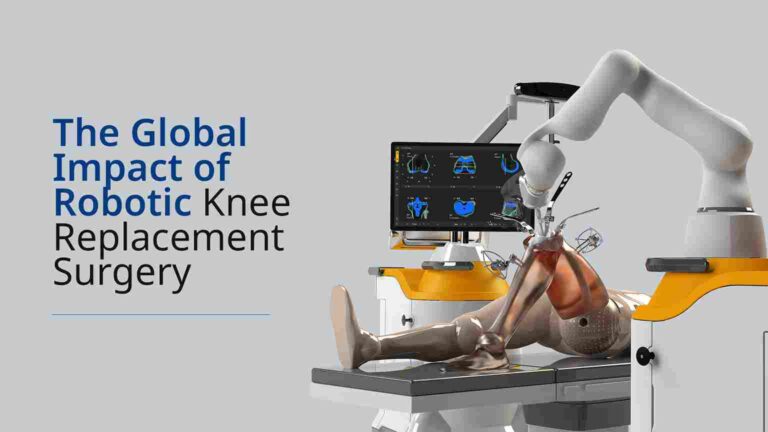 Revolutionizing Orthopedic Care: The Global Influence of Robotic Knee