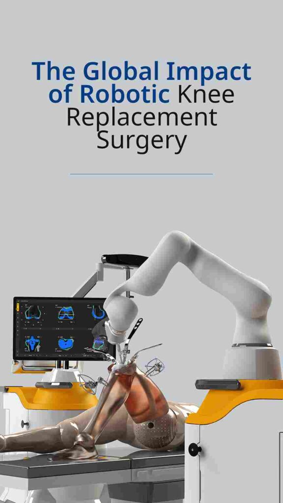 Robotic Assisted Knee Replacement Surgery