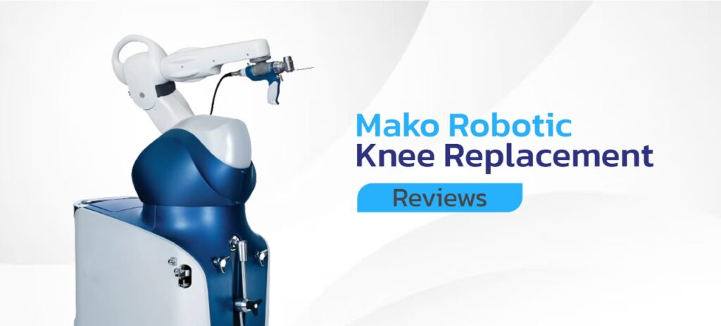 mako-robotic-knee-replacement-reviews