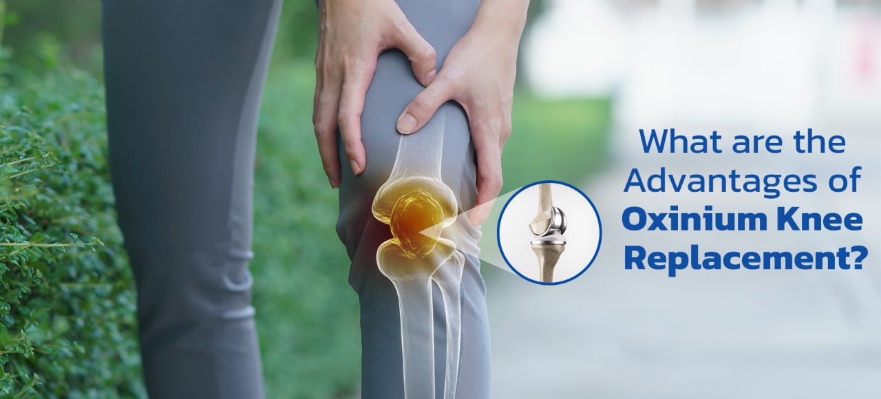 What are the advantages of oxinium knee replacement