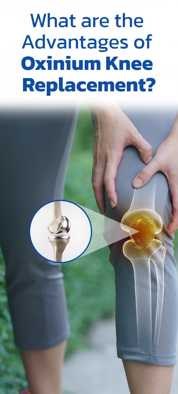 What are the advantages of oxinium knee replacements