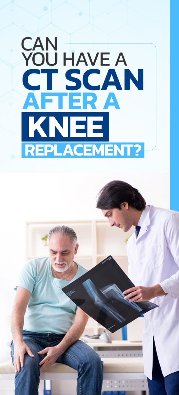 Can you have CT scan after knee Replacement